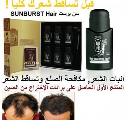 سن برست الاصلي لعلاج تساقط الشعر للرجال والنساء SUNBURST