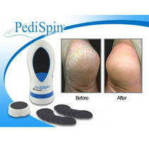 APPAREIL DE PÉDICURE ANTI CALLOSITÉS PEDI SPIN